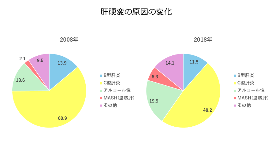 肝硬変の原因の変化